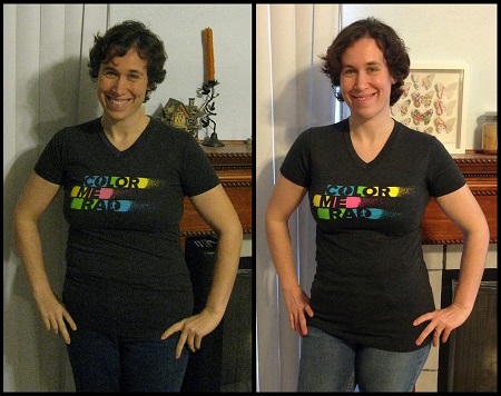 5 wks post op compare